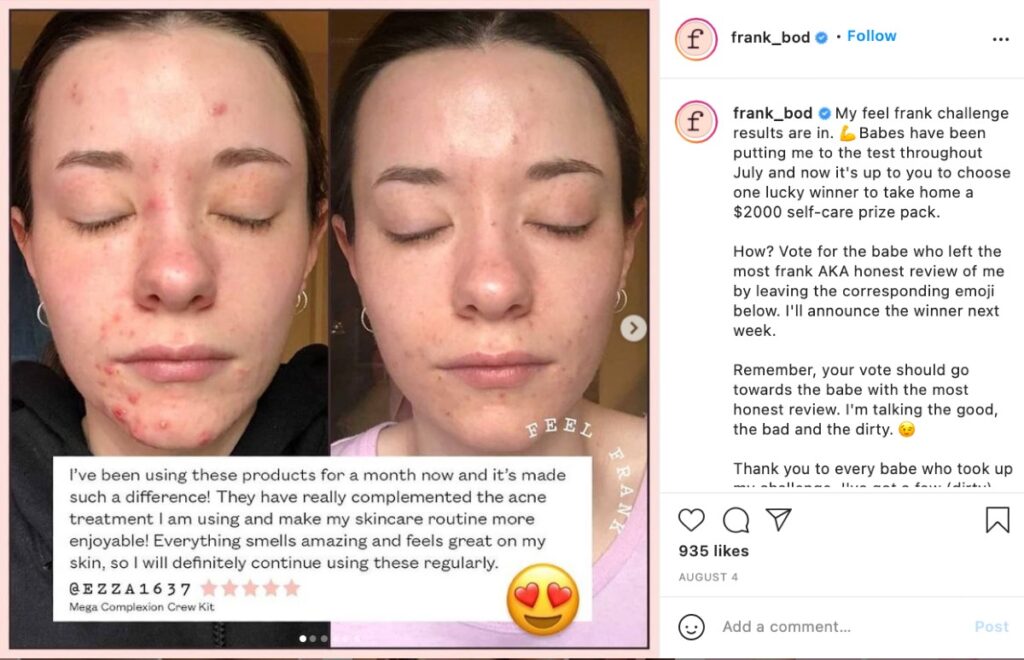 An instagram post by Frank Body, asking fans to swipe through different testimonials and vote for the most honest one. Winner gets a free self-care pack priced at $2,000.  